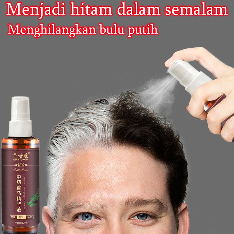 Hitam spray Hair growth serum spray Anti tonik rambut rontok Pertumbuhan rambut cepat 100ml Rambut putih tercepat di Indonesia menjadi rambut hitam Ekstrak tumbuhan alami Rambut hitam permanen