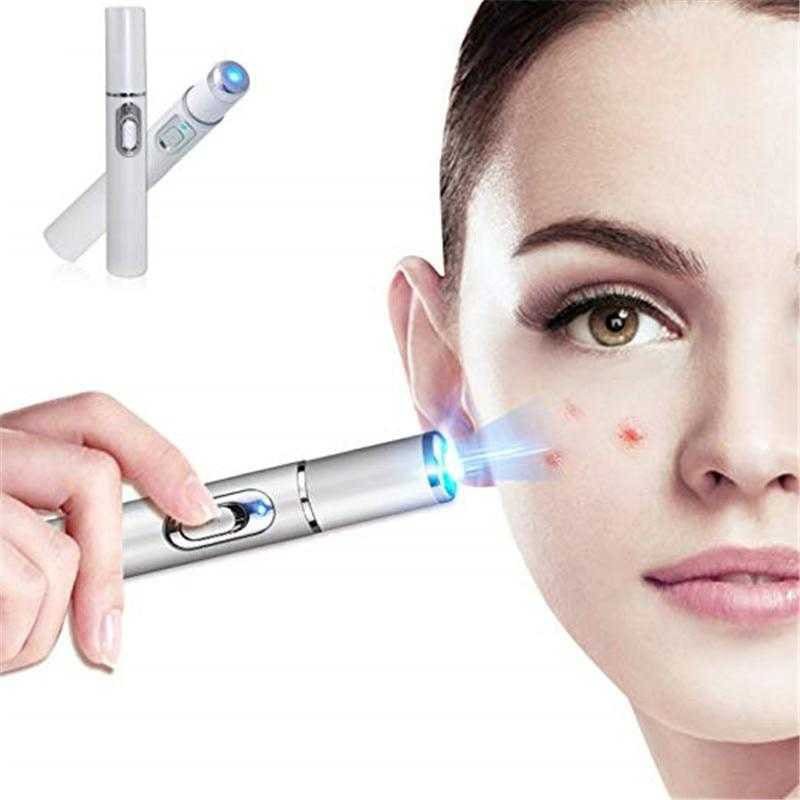 Pen LED Biru Laser Penghilang Jerawat Acne Treatment - KD-7910