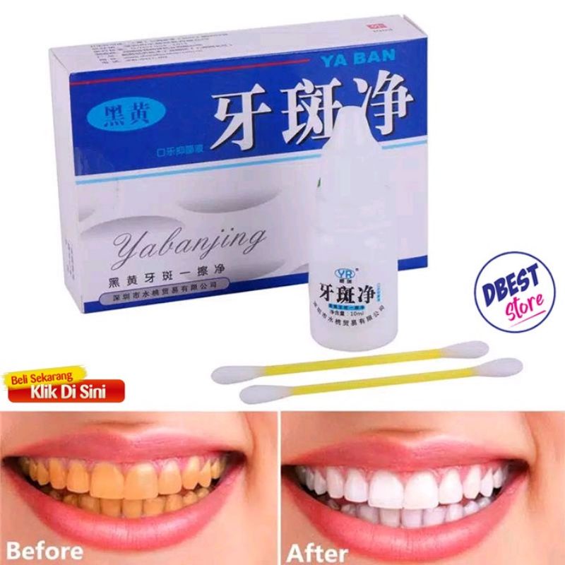 Pemutih Gigi Kuning Kerak Penghilang Karang Permanen Original Ampuh Teeth Whitening Odol Pasta Bpom