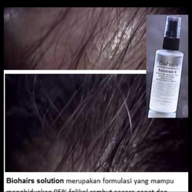 Bio Hair Solution New (Formula terbaru)