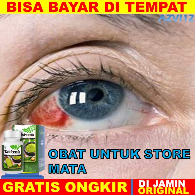 obat store mata OBAT STORE MATA, OBAT PENYUMBATAN PEMBULUH DARAH DIMATA, OBAT RETINOPATI HIPERTENSI 
