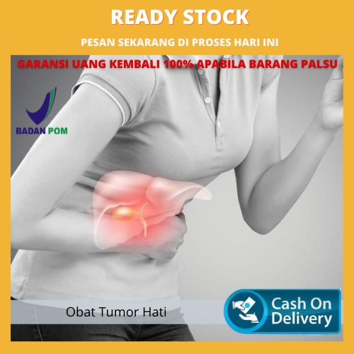 Obat Tumor Hati Herbal, Obat Kanker Liver, Kanker Hati Primer, Gejala Liver Rusak, Pembengkakan Peru