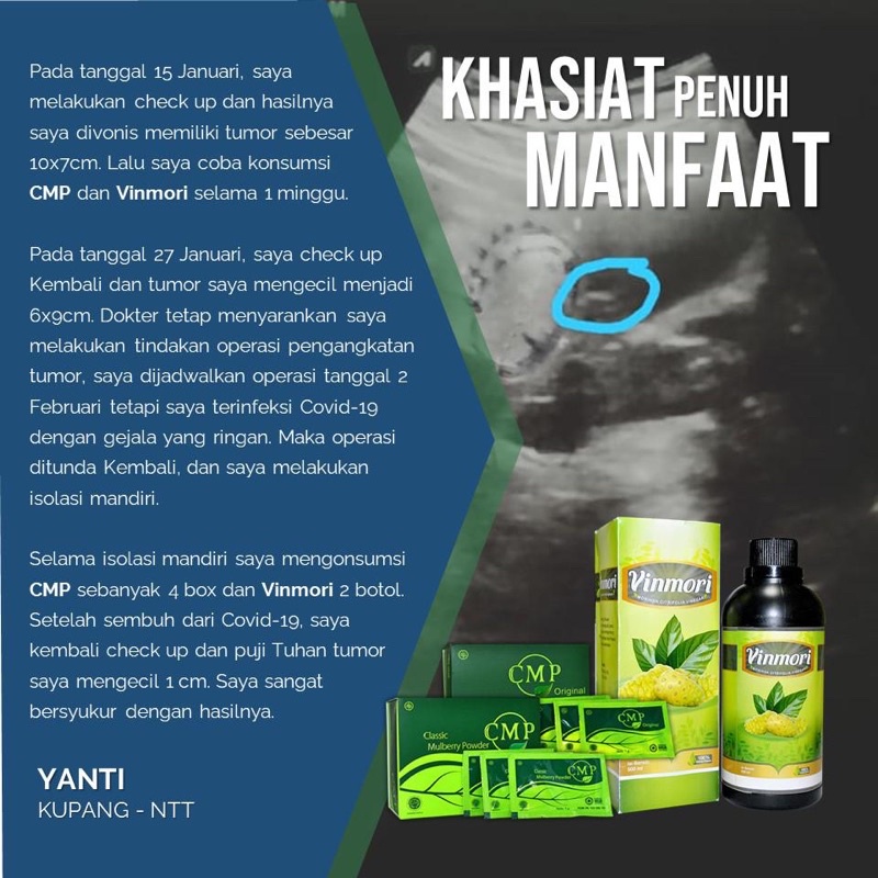 

Paket Penghilang B•e•n•j•o•l•a•n