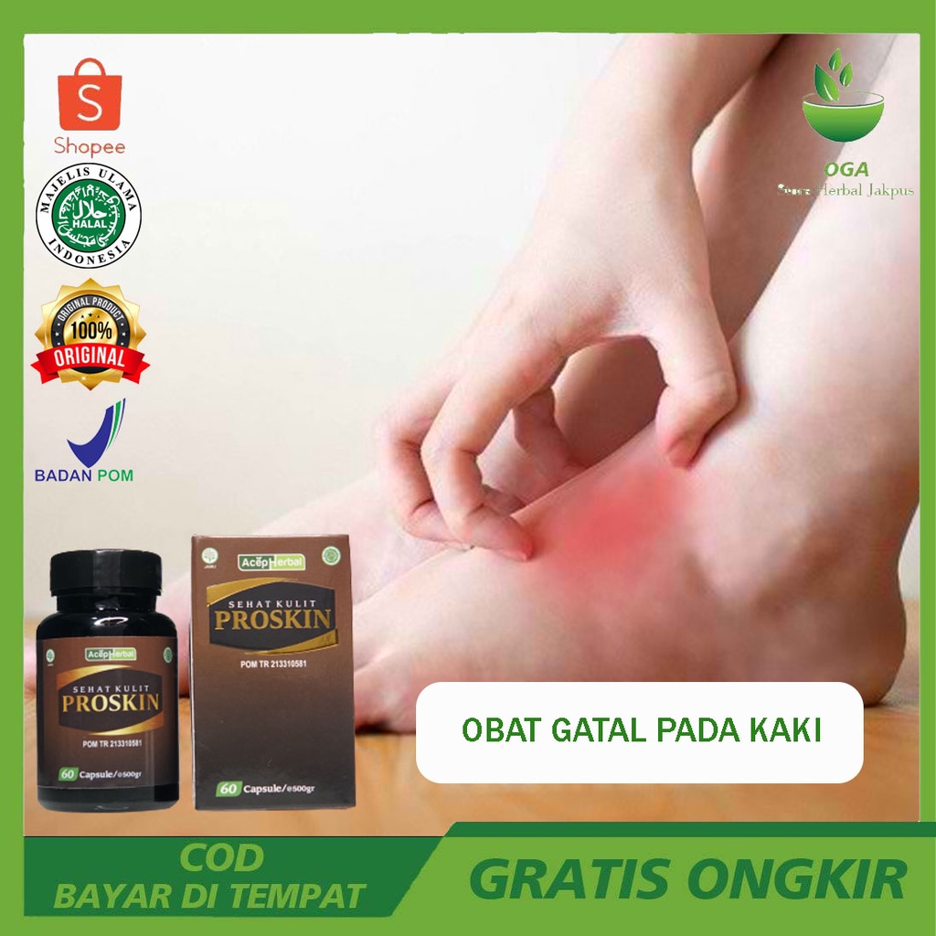 Obat Kaki Gatal Alergi Selangkangan Gatal Scabies Kudis Koreng Gudik Herpes Eksim Panu Kadas Kurap