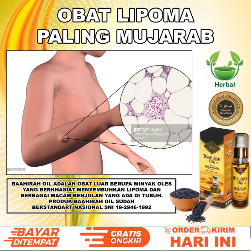 [MINYAK OLES BAAHIRAH OIL]- BENJOLAN GONDOK - OBAT BENJOLAN LIPOMA - KANKER - UCI UCI -