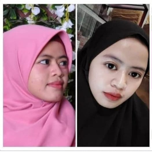 SKINCARE WAJAH GLOWING THERASKIN ACNE GLOW CREAM GLOWING PENCERAH WAJAH TONER WAJAH FACIAL WASH CREAM WAJAH GLOWING BPOM PAKET GLOWING PERAWATAN WAJAH