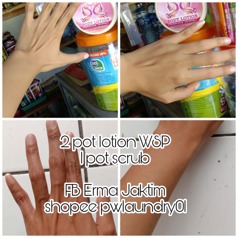 lotion pemutih kulit WSP lotion whitening dosting