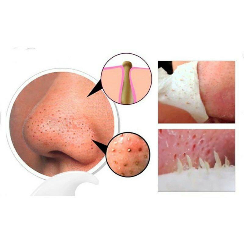 Masker Komedo|Masker HidungMasker Lanbena