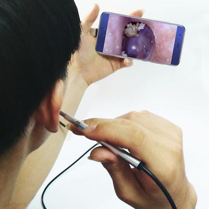 Korek Kuping Kamera Endoscope HD Visual USB 3 in 1 Earpick 6 LED [PM]