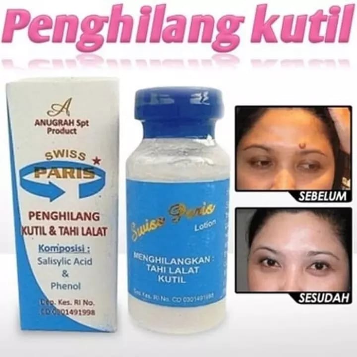 SwissParis Lotion - Lotion Penghilang Kutil - Obat Penghilang Kutil - Obat Perontok Kutil Paling Ampuh Original - Obat Lotion Penghilang Perontok Kutil Kelamin dan Mata Ikan - Obat Penghilang Mata Ikan - Swiss Paris Original Lotion Penghilang Kutil