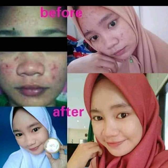 Wabeauty cream wa Beauty Mixspf memutihkan wajah, membuat wajah glowing
