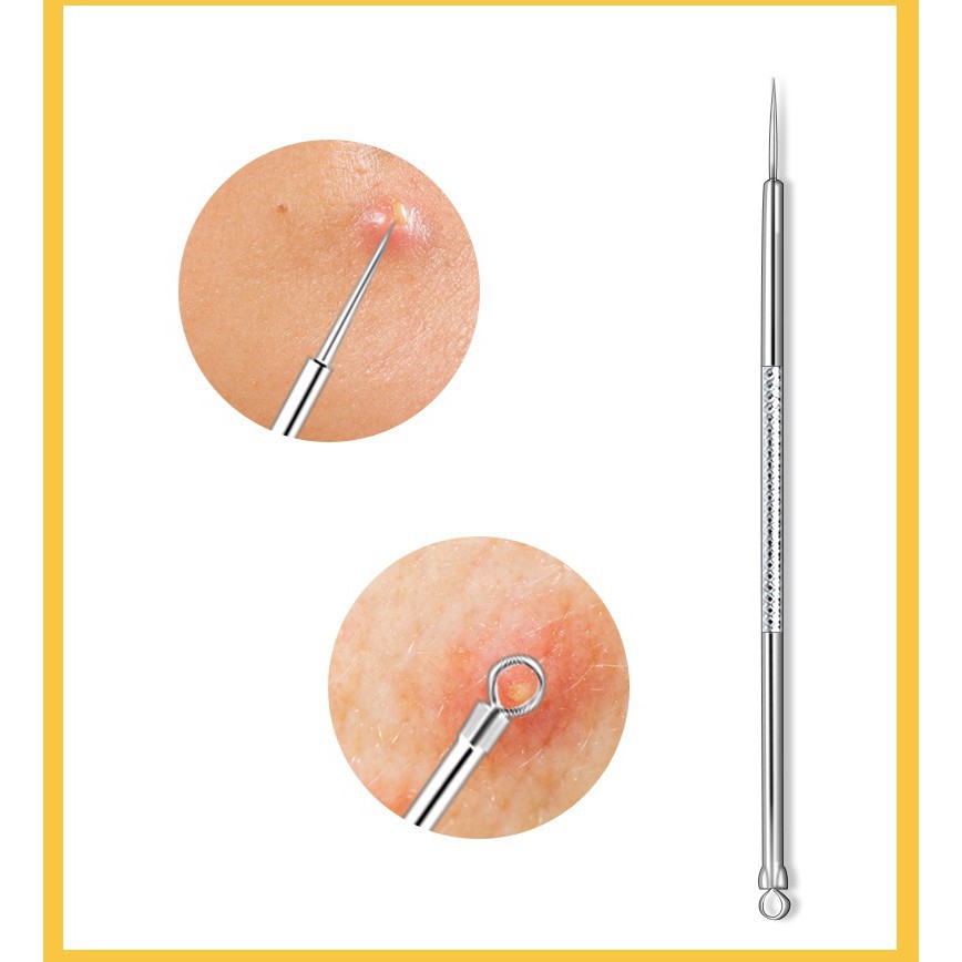 HL0140 Alat Pencet Jerawat Komedo Set 4 In 1 Pinset Jerawat Pembersih Blackhead