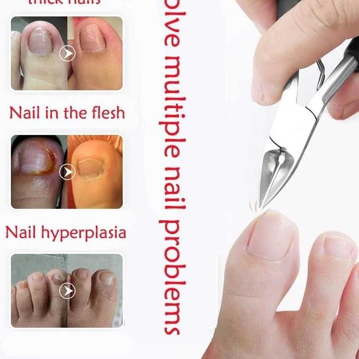 Grosir Termurah Kumplit Gunting Pemotong Kuku Jempol Kaki Miring Anti Cantengan Set / Alat Potong Ku