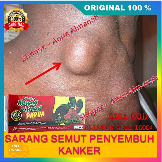 

PRIOMO! BELI 1 GRATIS 1 Teh Sarmut Papua Menghempaskan Benjolan 100% ASLI ORIGINAL