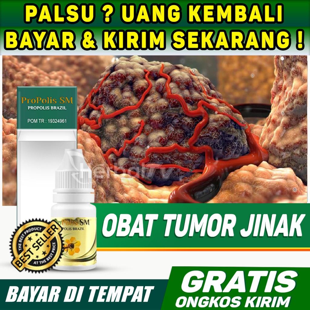 Obat Tumor Jinak - Herbal Atasi Tumor Payudara, RAHANG, Tulang, hidung | Propolis Terbaik Sudah BPOM