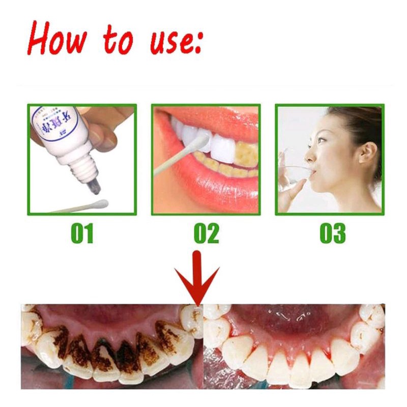 Yabanjing pemutih gigi dan penghilang karang gigi berkualitas