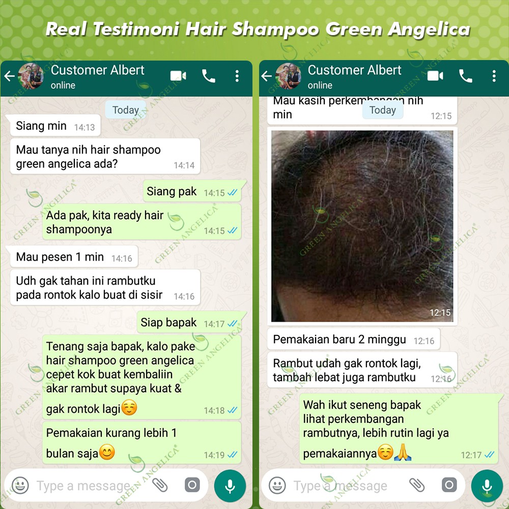 SHAMPO PENUMBUH RAMBUT BOTAK Akibat Rontok Parah, Menghilangkan Ketombe, Shampo Green Angelica BPOM-5