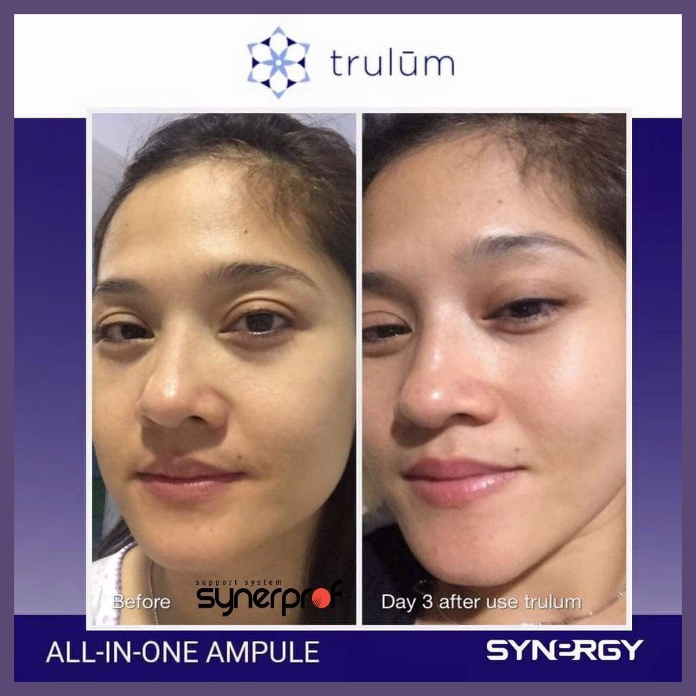 Penghilang Keriput Pada Wajah Trulum Pengganti Krim Wajah Dokter BPOM