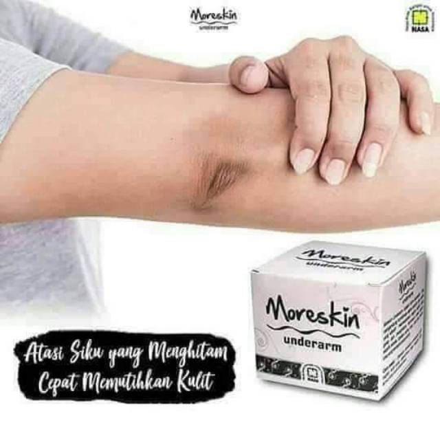 Moreskin underarrm nasa