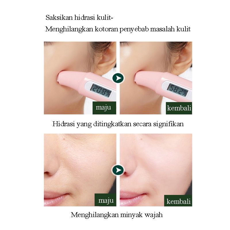 Sabun muka 300g Pembersihan Mendalam sabun cuci muka Penghapusan tungau/pembersihan / antibakteri /pelembab/degreasing