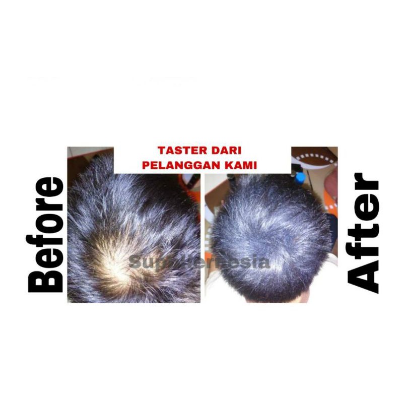 GROZIS Penebal Rambut Instan Rambut Terlihat Tebal Alami