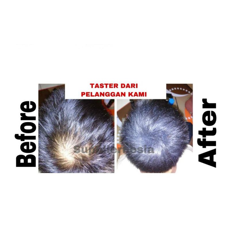 Toppik Penebal Rambut Cepat Toppik Hair Building Fiber Original USA / Hitam Seperti Caboki / Pelebat Rambut