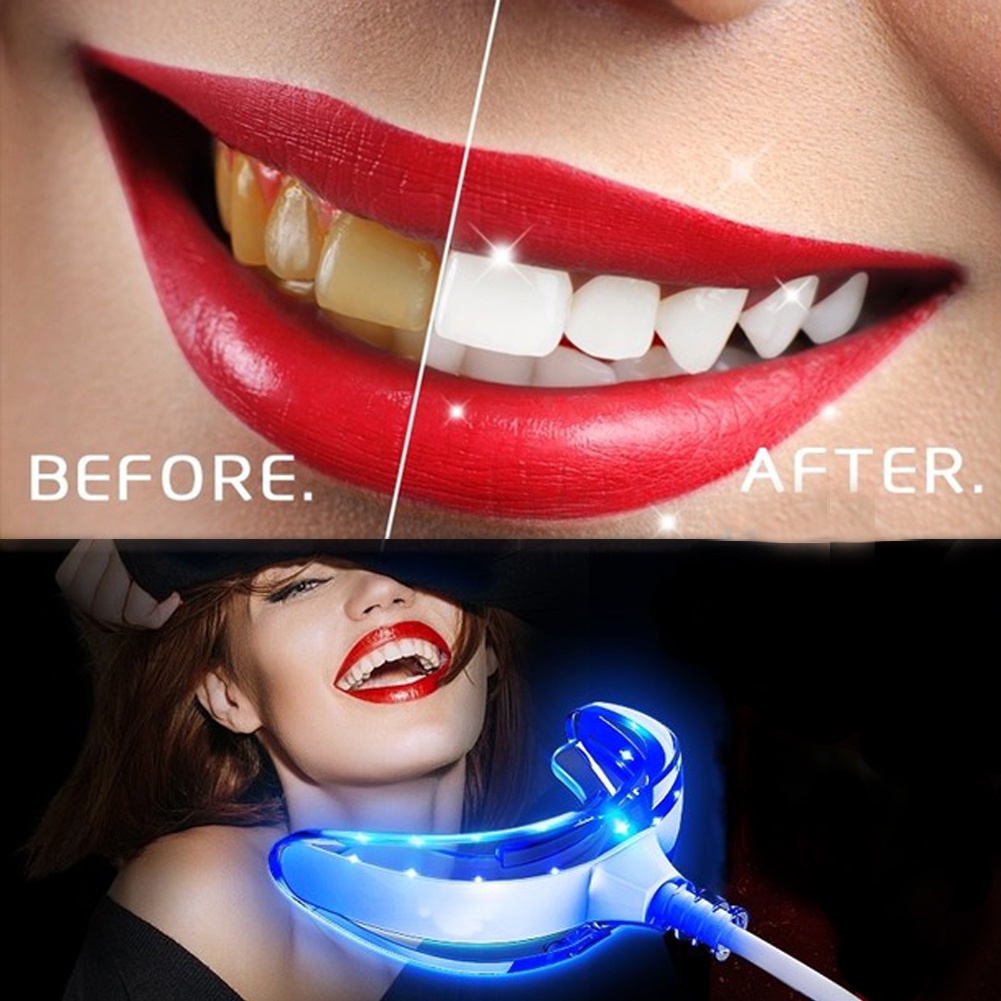 Teeth Whitening Alat pemutih gigi perawatan kesehatan mulut personal. Set alat pemutih gigi profesional memutihkan gigi kuning perokok