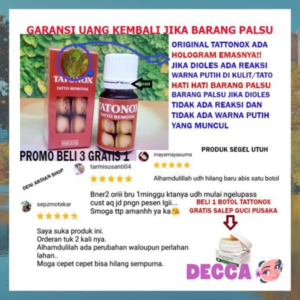 [HOTCHECK] BAYAR DI TEMPAT CARA MENGHILANGKAN TATO ATAU TATTOO DENGAN TATTONOX