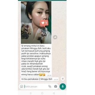 Diskon✔️SR GLOW SKINCARE BPOM PERAWATAN WAJAH AMAN BPOM|KD4