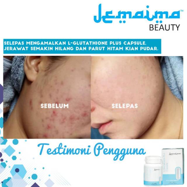 Jemaima / Pill Whitenin / Vitamin C