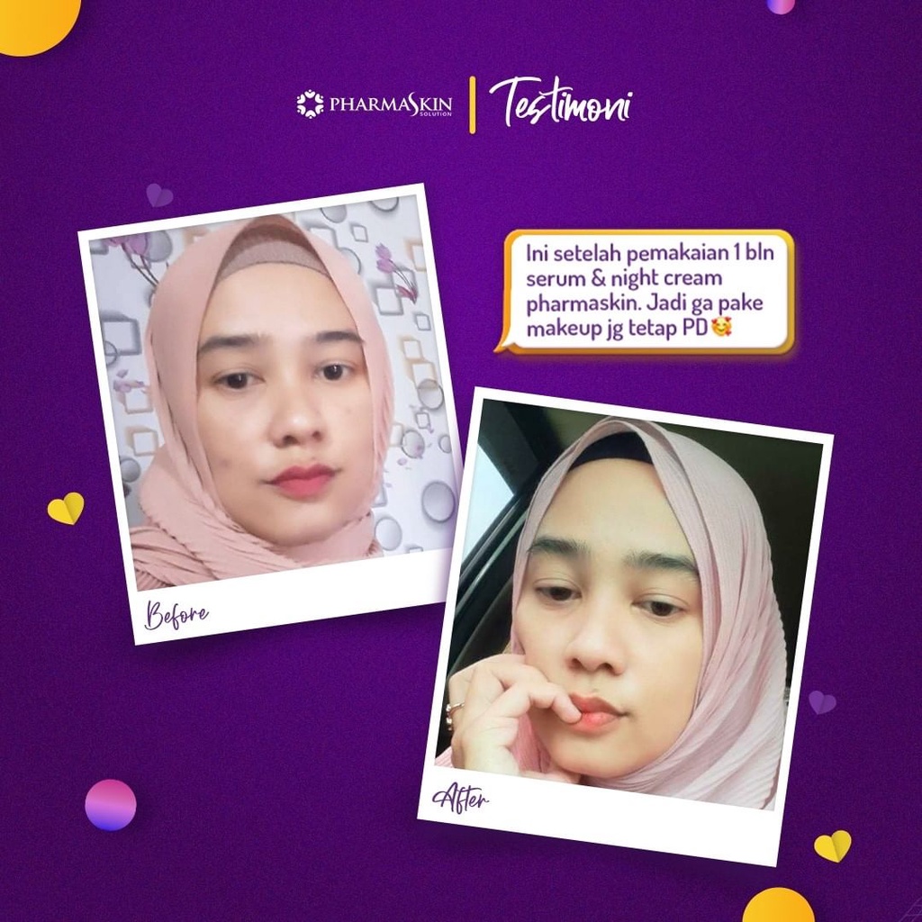 Pharmaskin Intensive Night Flek [Gratis Pouch]-2
