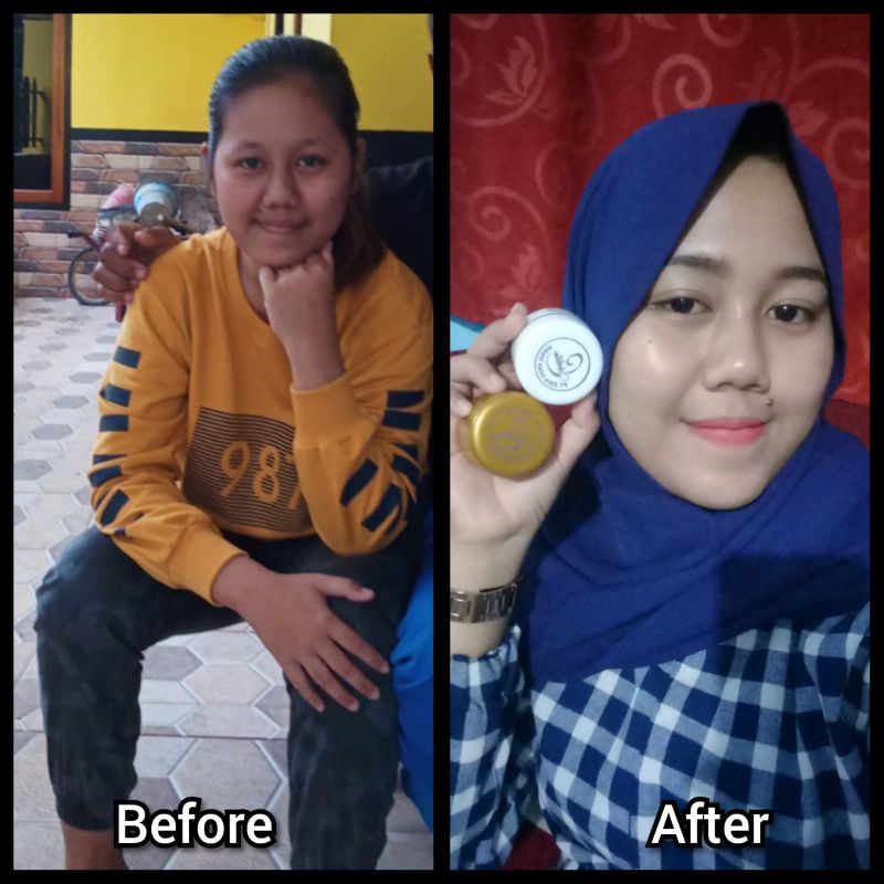 Formula Baru BEBWHITE C SKINCARE BPOM