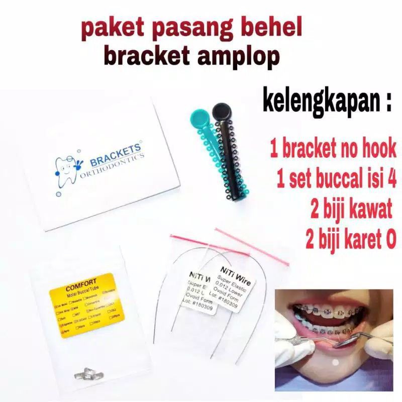 Behel Permanen Metal Bracket Amplop