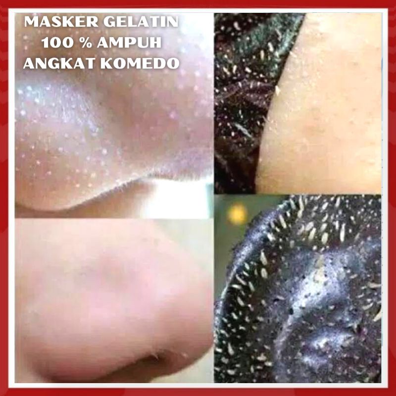 Masker Gelatin Pengangkat Komedo