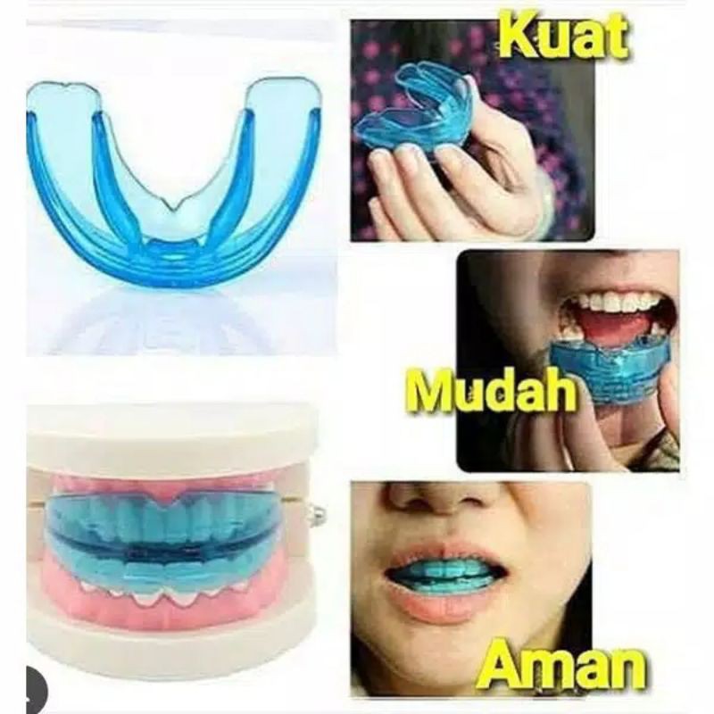 ALAT PERAPI GIGI PENGGANTI BEHEL ORIGINAL TEETH MERAPIKAN MENATA GIGI PERATA