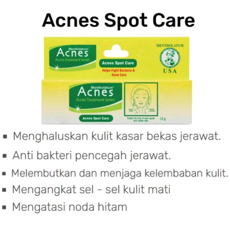 Acnes Spot Care 12g / Obat Jerawat Acnes Spot Care