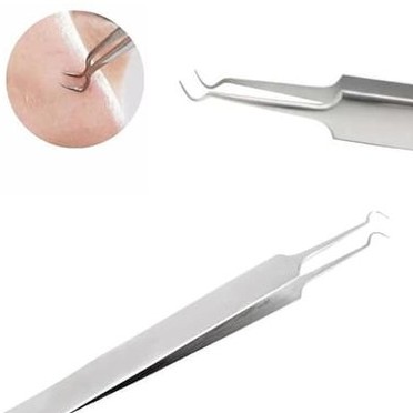 Pinset Penjepit Komedo