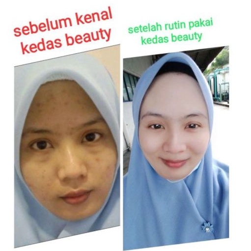 GOLD JELY KEDAS BEAUTY {100%ORIGINAL BPOM} TERLARIS PAKET GLOWING-5