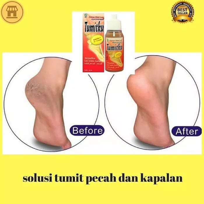 TUMITKU 30ML (CAIRAN OBAT LUAR UNTUK KAKI PECAH-PECAH)