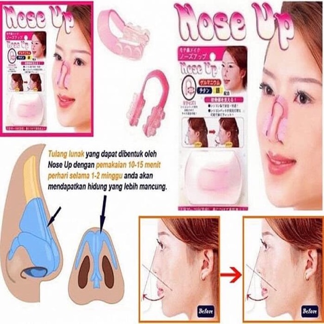 NOSE UP CLIPER / ALAT PEMANCUNG HIDUNG ORIGINAL