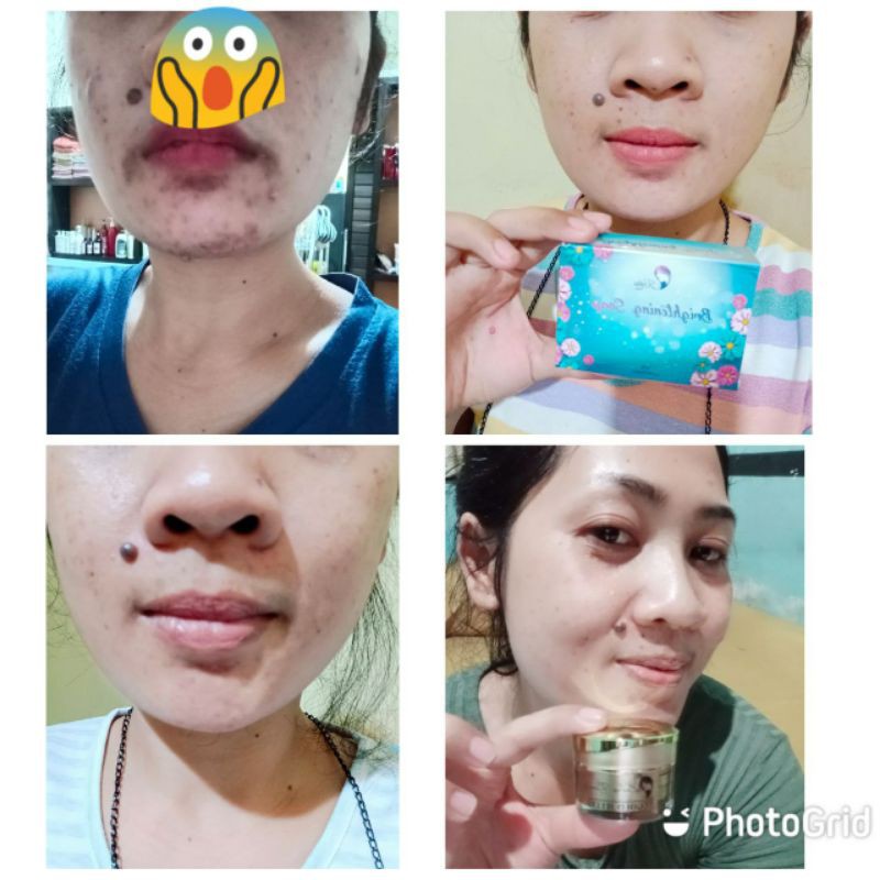 Brightening Soap Kedas Beauty | BPOM Best Seller-5