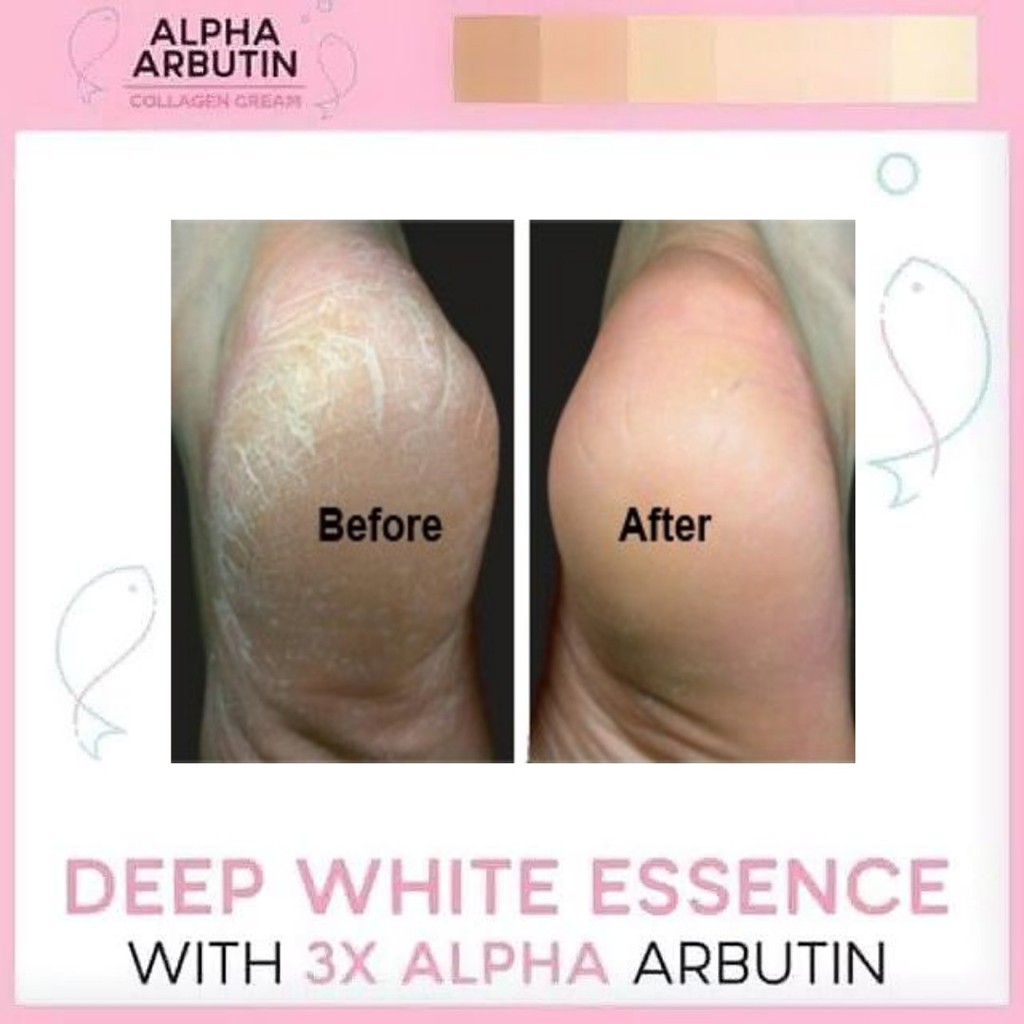 ALPHA ARBUTIN 3 PLUS COLLAGEN DEEP ESSENCE WHITENING CREAM JUMBO BPOM/CREAM PEMUTIH COLLAGEN 100ml