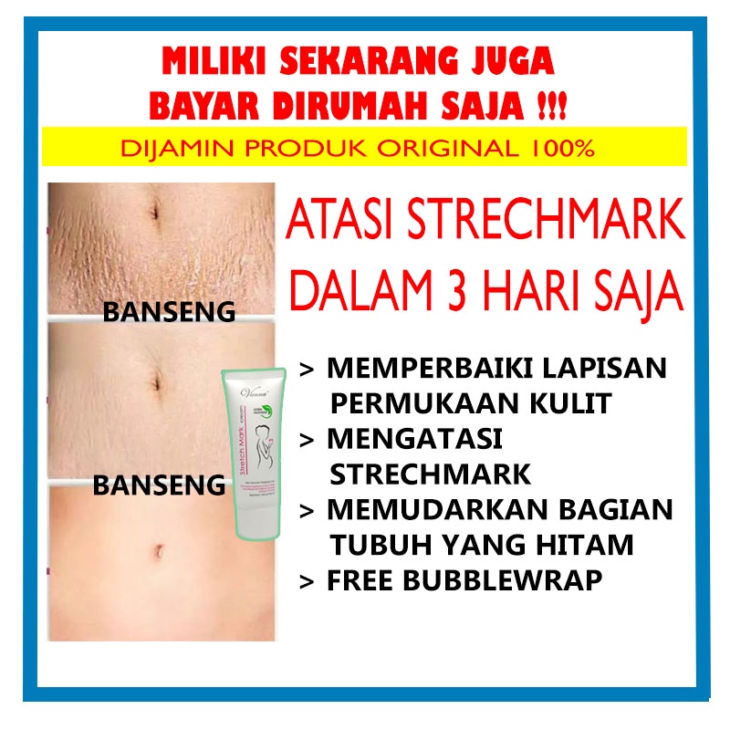 Krim Penghilang Strechmark Penghilang Selulit Tubuh Penghilang Kerutan Cream Penghilang Strechmark K