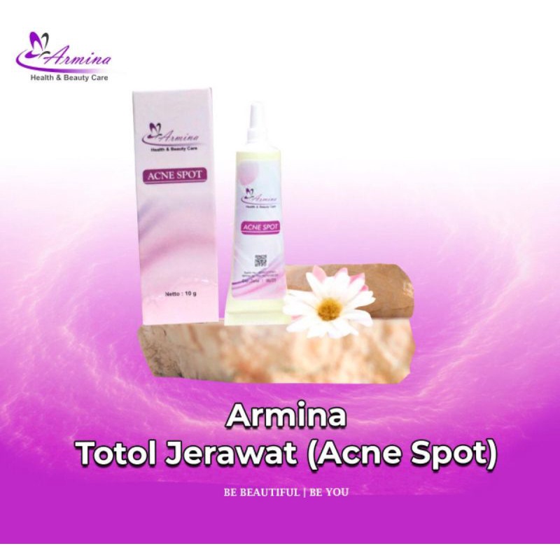 Totol Jerawat (Acne Spot)