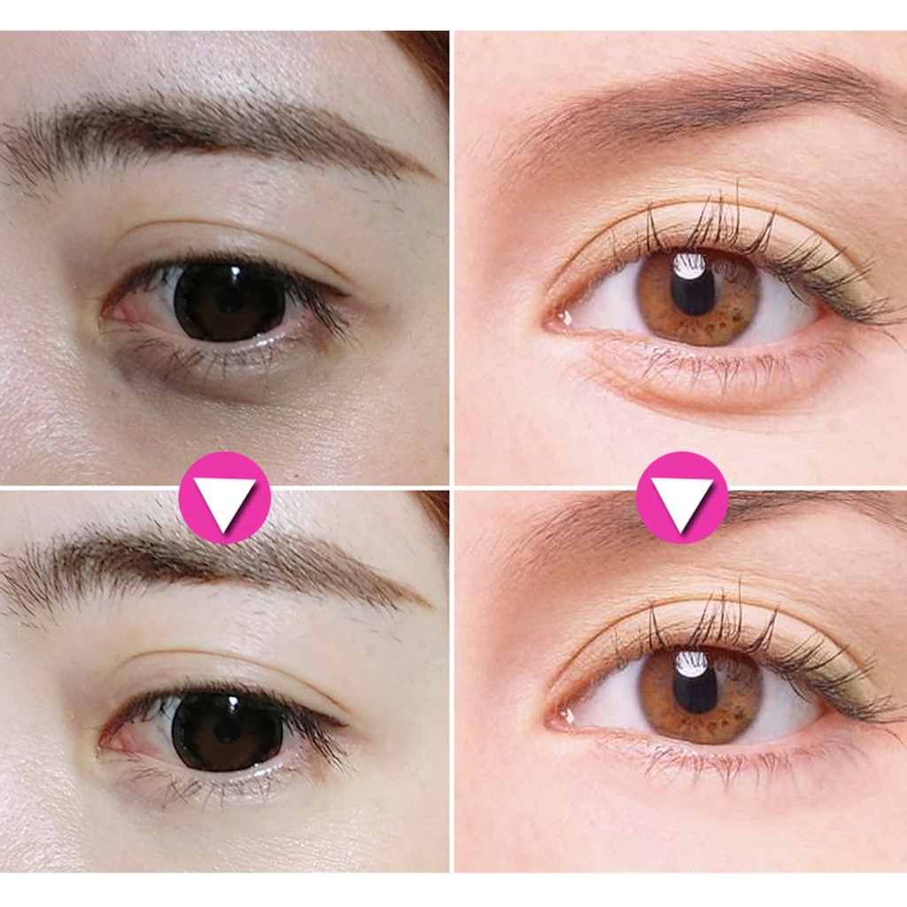 eye cream somethinc eye crem Krim Mata Anti-kerut Krim menghilangkan lingkaran hitam Krim Mata Mawar Esensi Melembabkan Dan Anti-penuaan Perawatan Pelembab Mata Mencerahkan Dan Memperbaiki Kulit Kusam Mengurangi Lingkaran