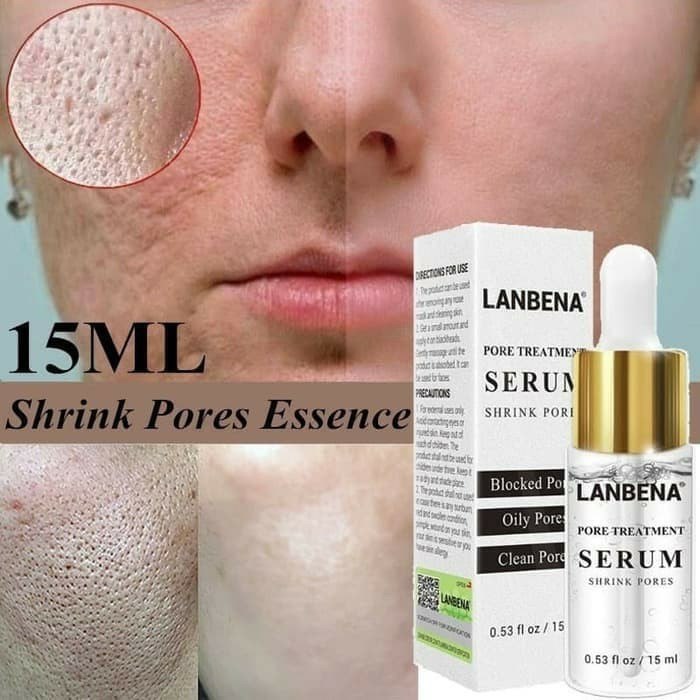 LANBENA PORE TREATMENT SERUM / SERUM PERAPAT PORI - PORI KULIT WAJAH