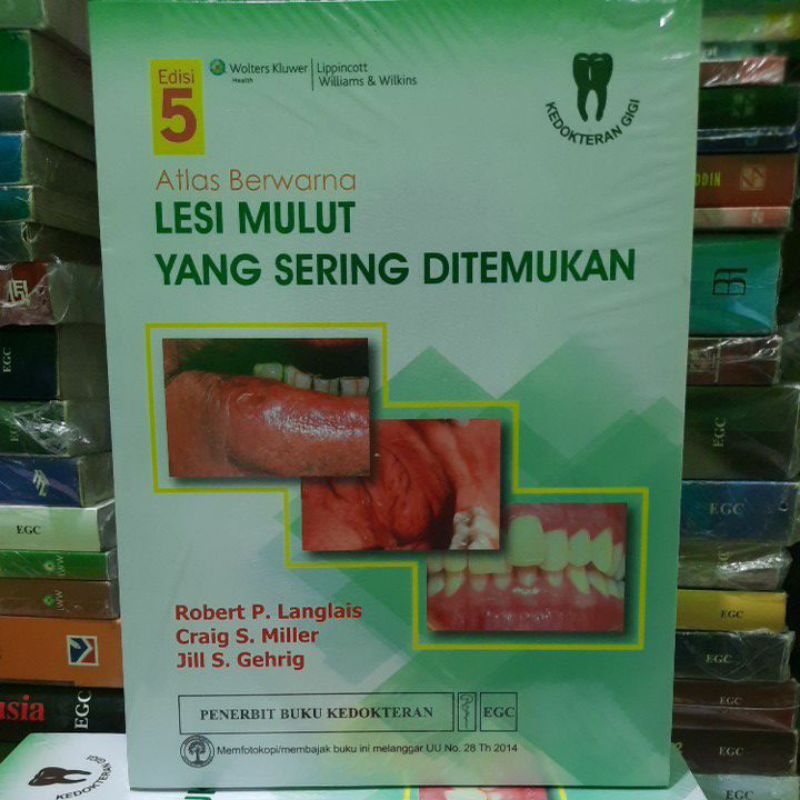 ATLAS BERWARNA LESI MULUT YANG SERING DI TEMUKAN ORIGINAL  FULL COLOUR
