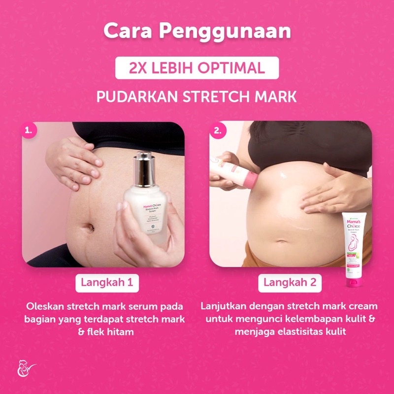 Mama Choice Stretch Mark Serum Penyamar Flek Hitam Pelembab Perut Ibu