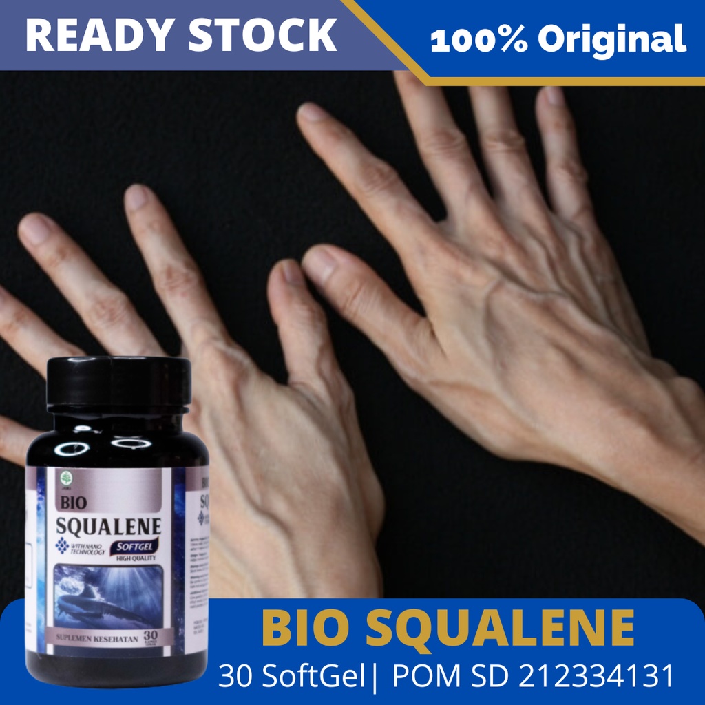 Obat Penghilang Varises, Varises Tangan, Varises Di Betis Kaki, Paha, Varises Akut, Urat Varises Men