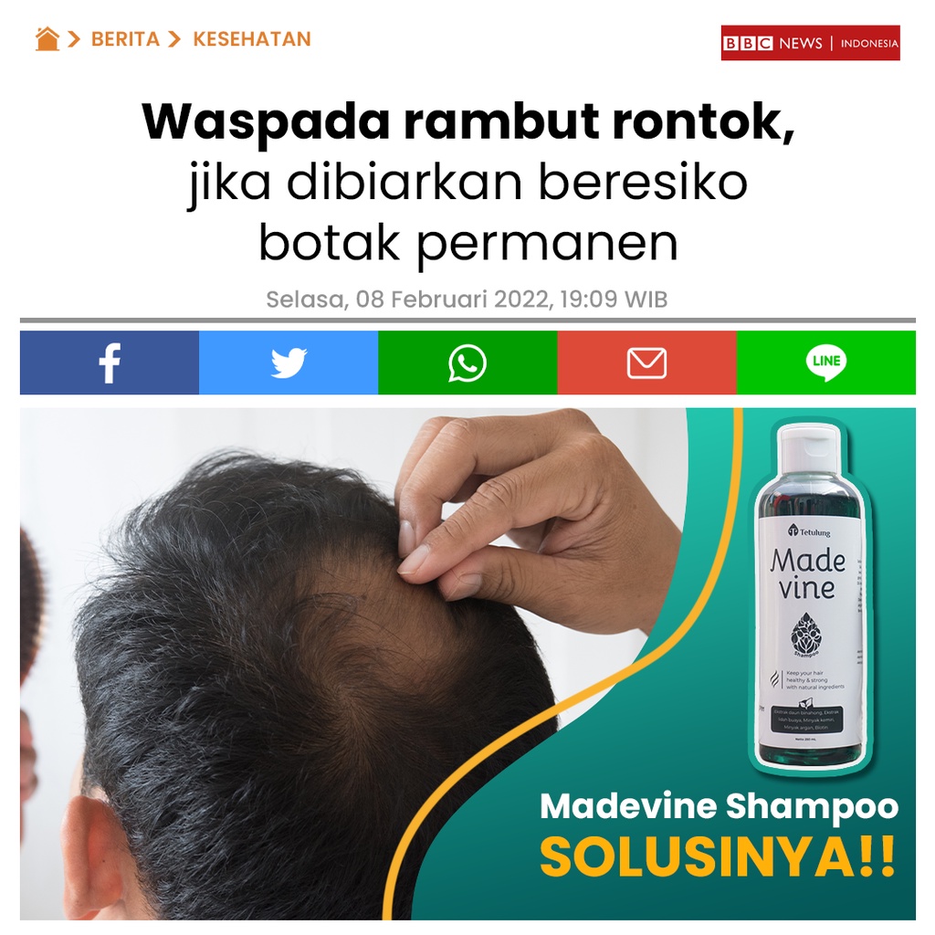 Shampo Rambut Rontok, Sampo Rambut Rusak Ketombe dan Penyubur Rambut untuk Pria atau Wanita - Madevine